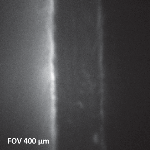 X-ray beam induced secondary electrom image