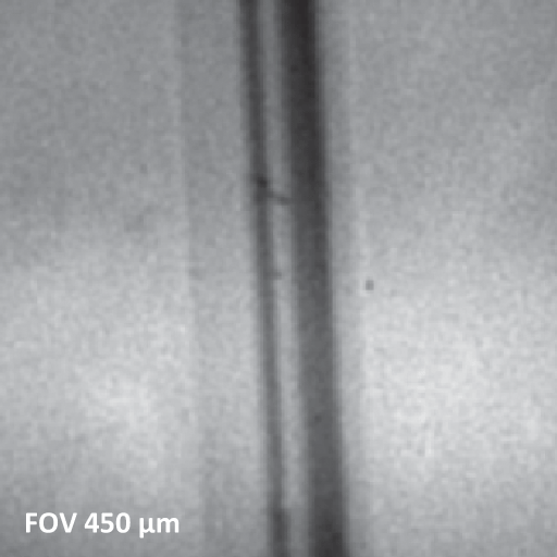 X-ray beam induced secondary electron image